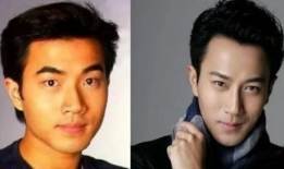 娱乐圈吃瓜爆料男星整容,男星整容风波，真相背后竟是这样...